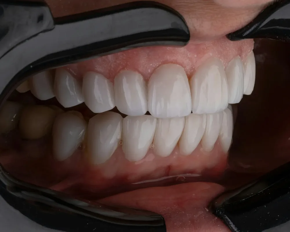 Patient smile — sample gallery image