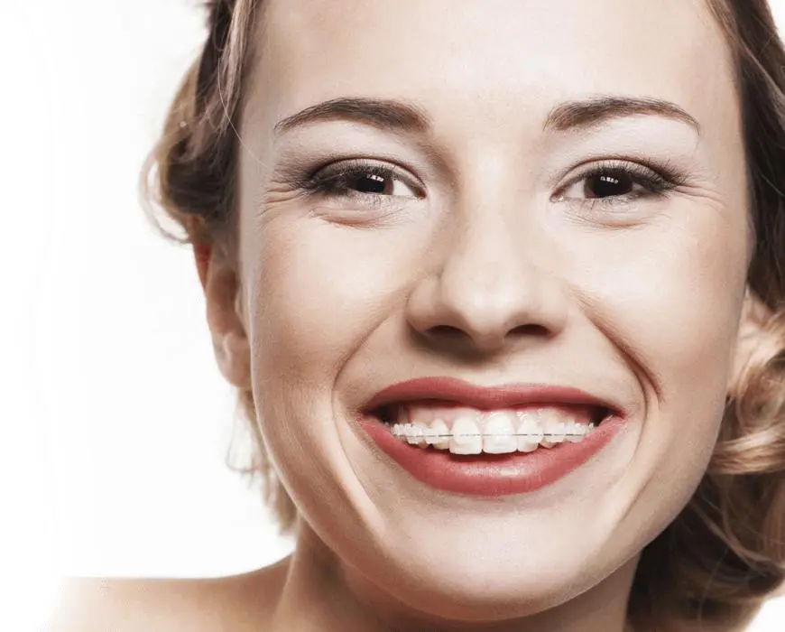 A smiling patient wearing clear ceramic braces